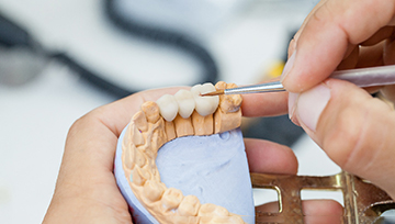 Dentist designing a dental bridge in Ann Arbor