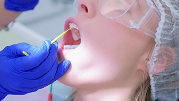 Patient receiving fluoride treatment