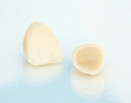 A close-up of metal-free ceramic dental crowns