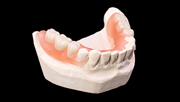 Model of teeth with partial denture