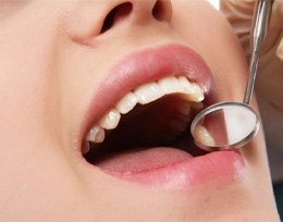 Patient with dental implants in Ann Arbor getting dental checkup