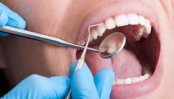 patient smiling at dentist 