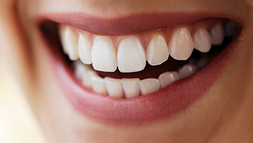 Closeup of healthy beautiful smile