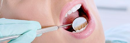 Closeup of teeth during dental exams