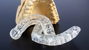 Hand holding a custom occlusal splint