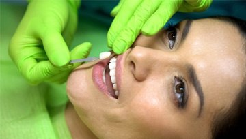 cosmetic dentist in Ann Arbor giving a patient veneers 